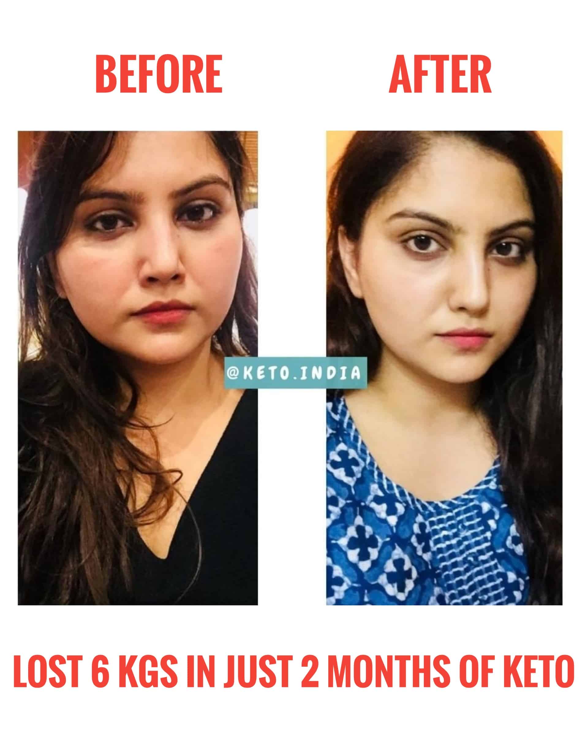 Ketogenic Success Journey Of Ayushi Keto India Transformation Stories