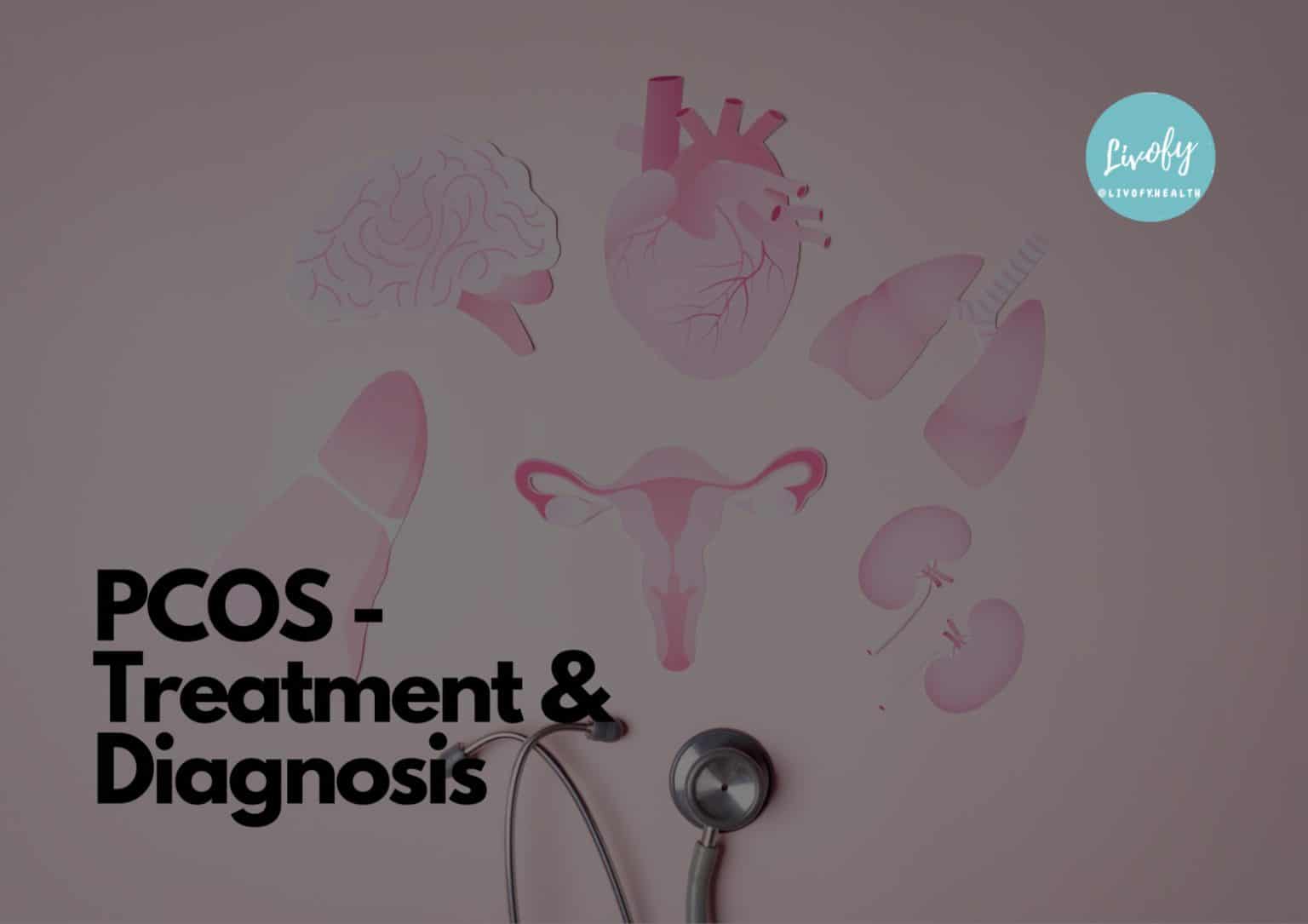 Polycystic Ovary Syndrome Pcos Treatment And Diagnosis Livofy 8349